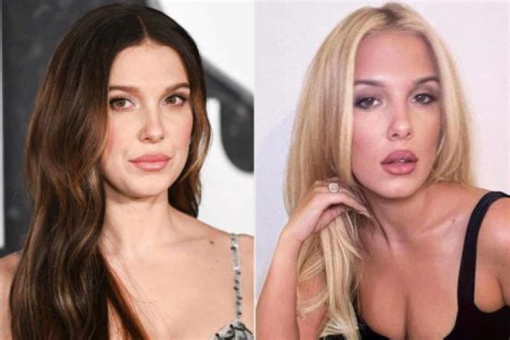 Analyzing Sabrina Carpenter's Lip Filler Rumors: Truth Or Fiction?