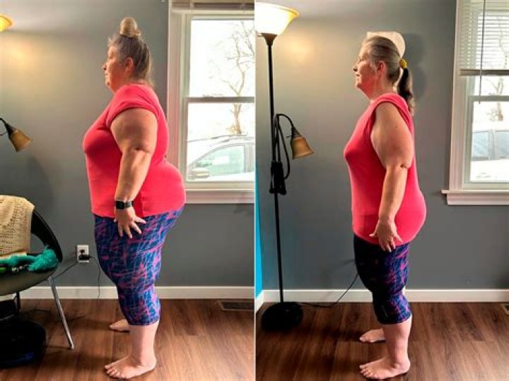 Discover The Truth: Melissa Etheridge's Weight Loss Journey