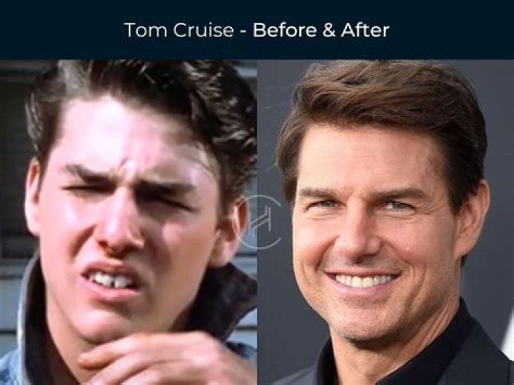 Exploring The Enigma: Tom Cruise And The Teth Connection