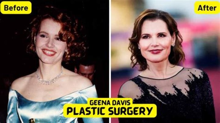 Geena Davis Surgery: The Truth Behind The Rumors