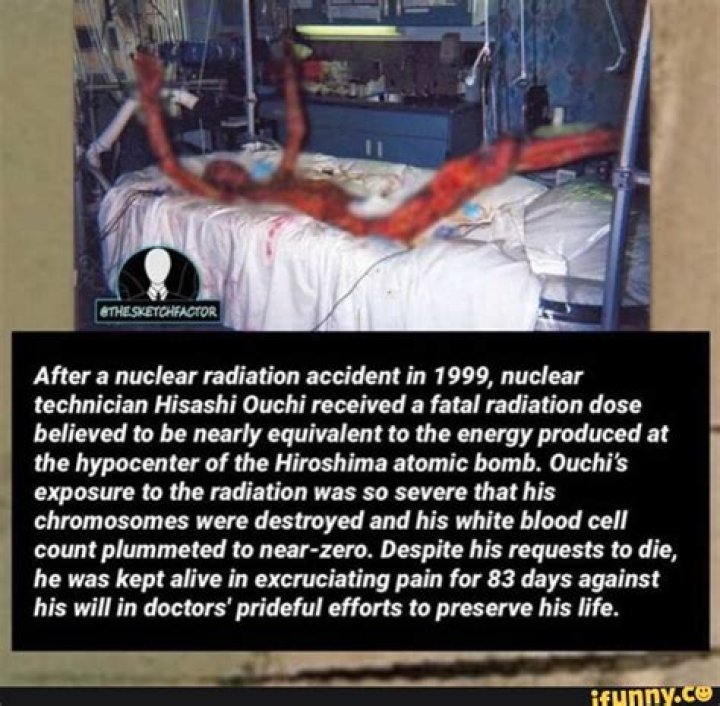 Hisashi Ouchi: A Tragic Tale Of Nuclear Accident And Endurance