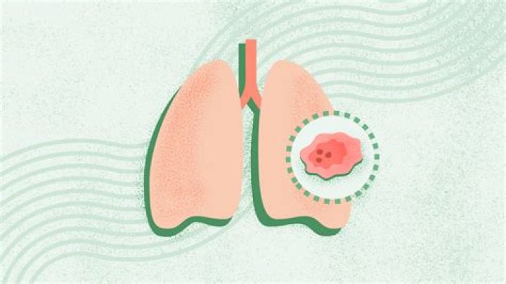 Is There Hope For Taylor's Parents To Reunite?