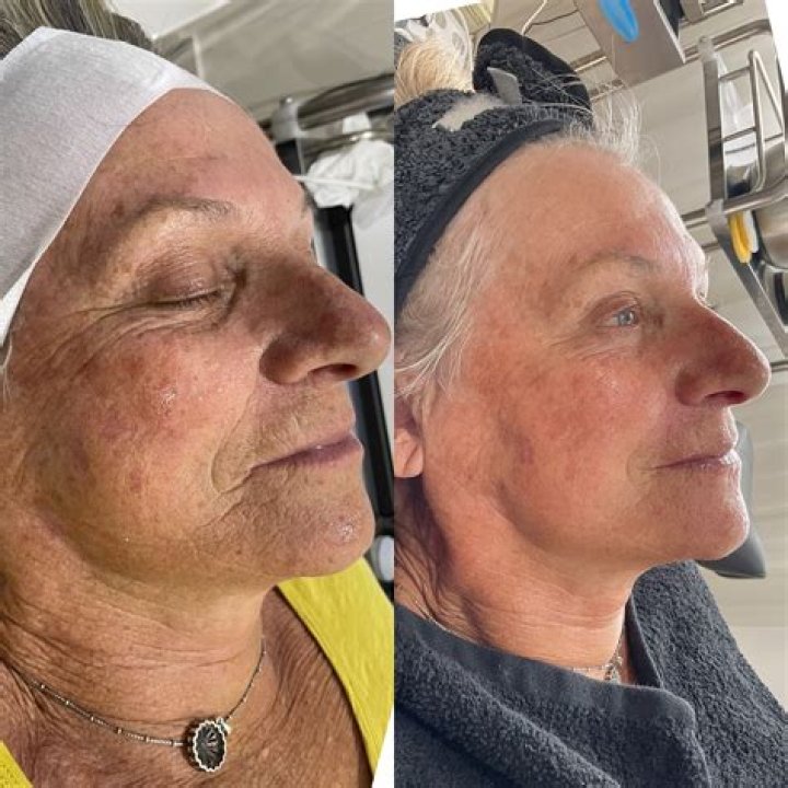 Liberty Love Island: The Transformation Before And After Surgery