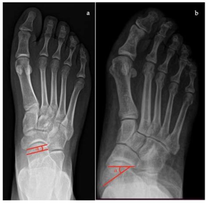 The Towering Height Of John Goodman: Uncovering The Actor's Stature