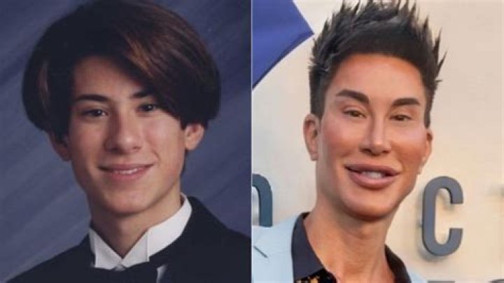 Transformative Journey: Justin Jedlica Before Plastic Surgery