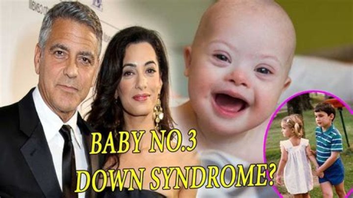 Uncovering The Truth: George Clooney And The Rumors Of A Child With Down Syndrome