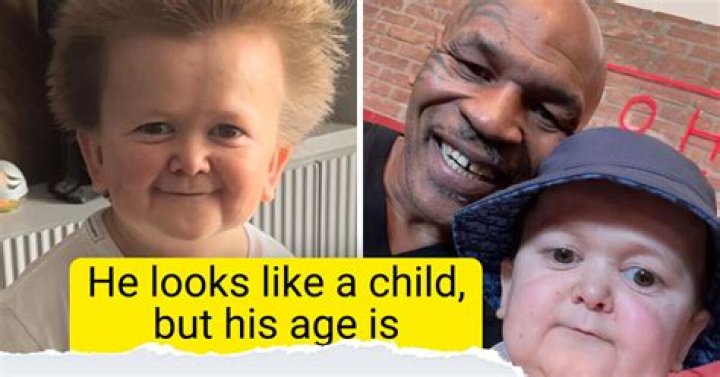 Unmasking The Enigma: Is Hasbulla A Genuine Phenomenon?