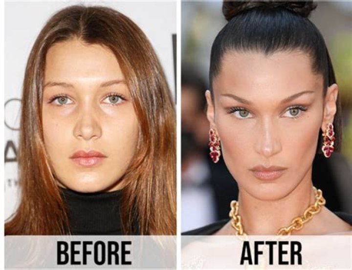Unveiling Bella Hadid: A Glimpse Before Plastic Surgery