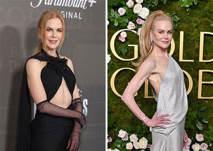 Unveiling Nicole Kidman's Weight Loss Diet: Secrets Of A Hollywood Star