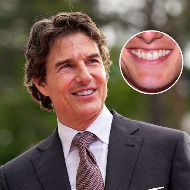 Unveiling The Mystery Of Tom Cruise's Centre Tooth