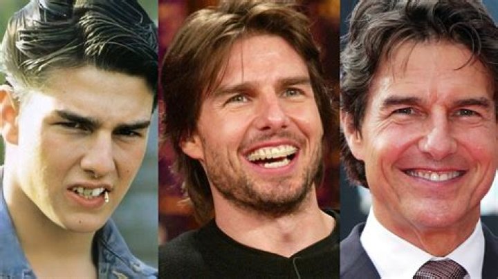 Unveiling The Mystery Of Tom Cruise's Tooth In The Middle