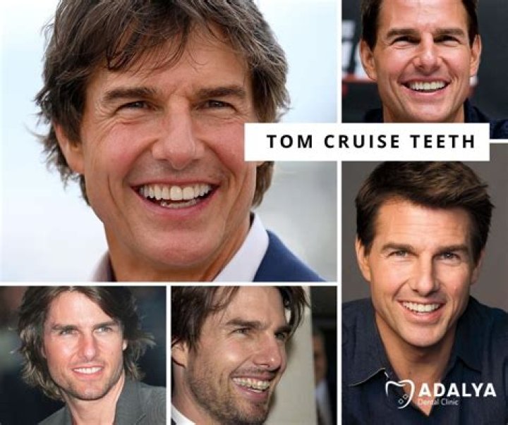 Unveiling The Secret Behind Tom Cruise's Iconic Smile: A Deep Dive Into Tom Cruise Teeth