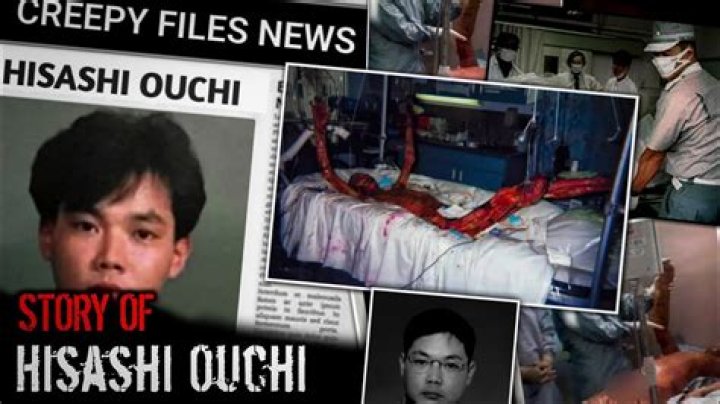 Unveiling The Tragic Tale Of Hisashi Ouchi: Real Photos From 1999